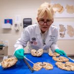 What is CTE and what NFL players have been diagnosed with it?